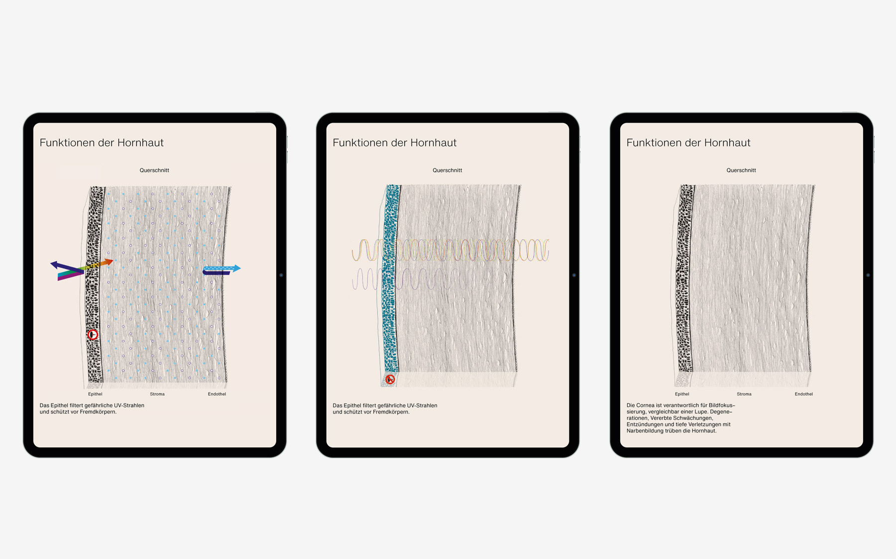 iPad screens showing transplantation of organs
